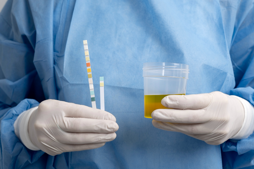 Urine Drug Tests Kits. Purposes and Types