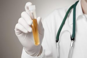Urine Drug Screening
