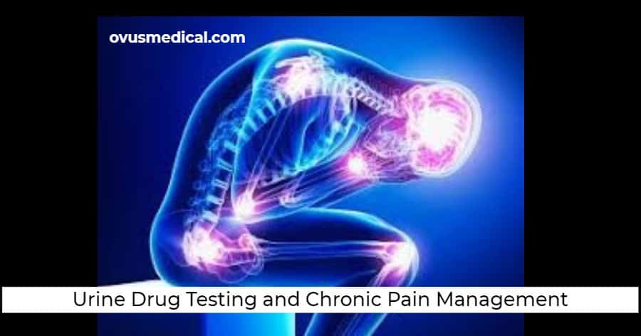 ovus medical Urine Drug Testing and Chronic Pain Management