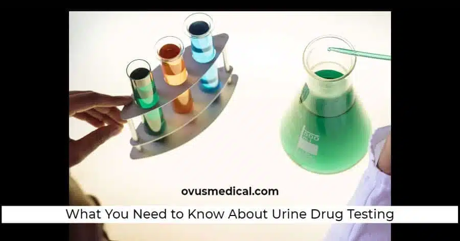 ovus medical What You Need to Know About Urine Drug Testing