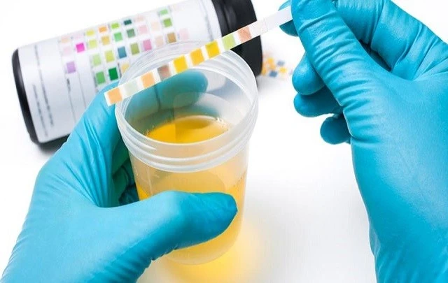 Best urine test products for diluted urine