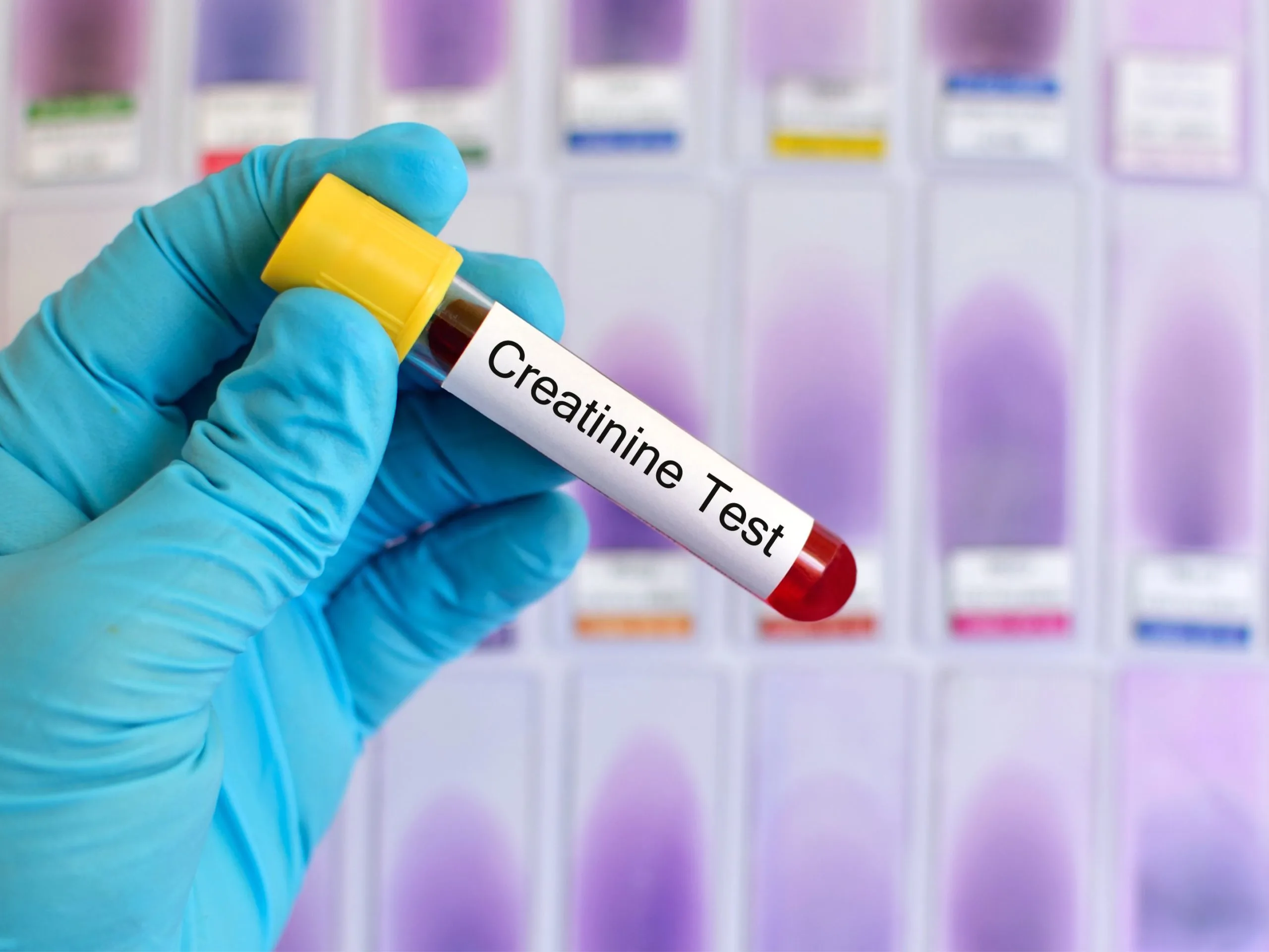 Creatinine test