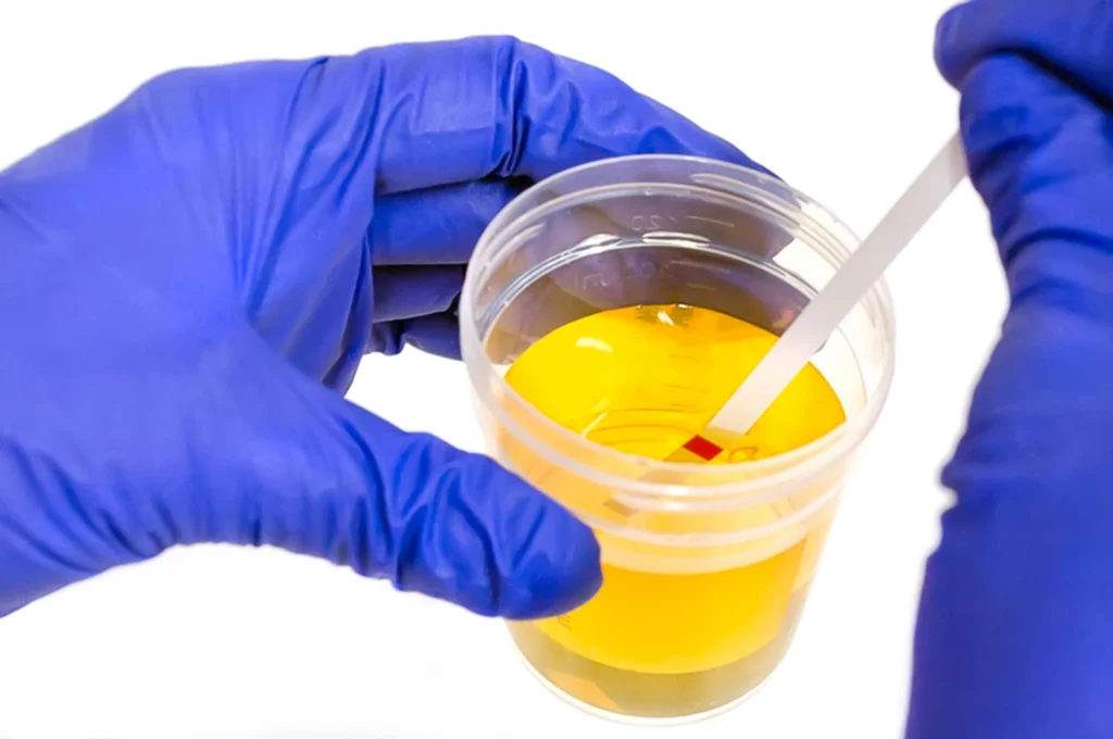 Urine drug test ovusmedical