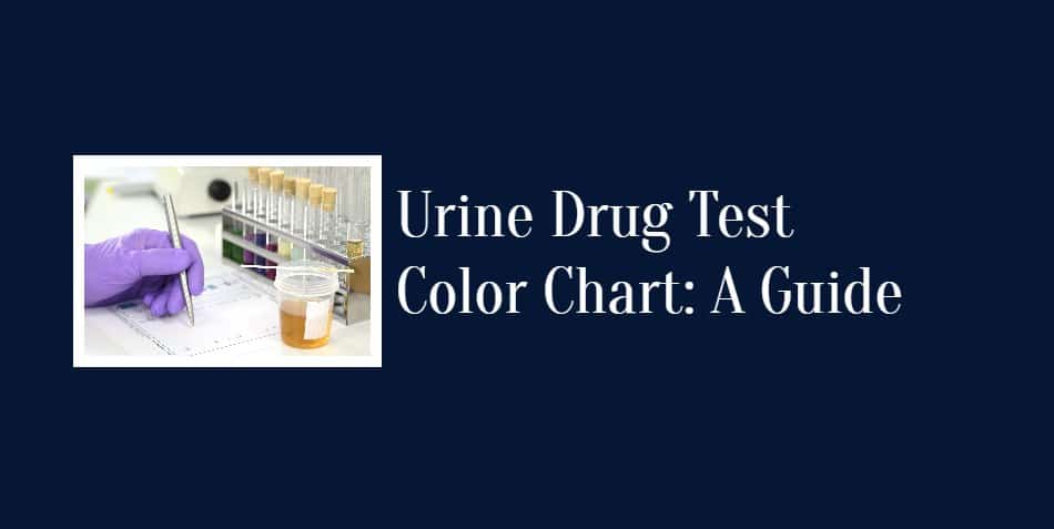 Urine Drug Test Color Chart: A Guide
