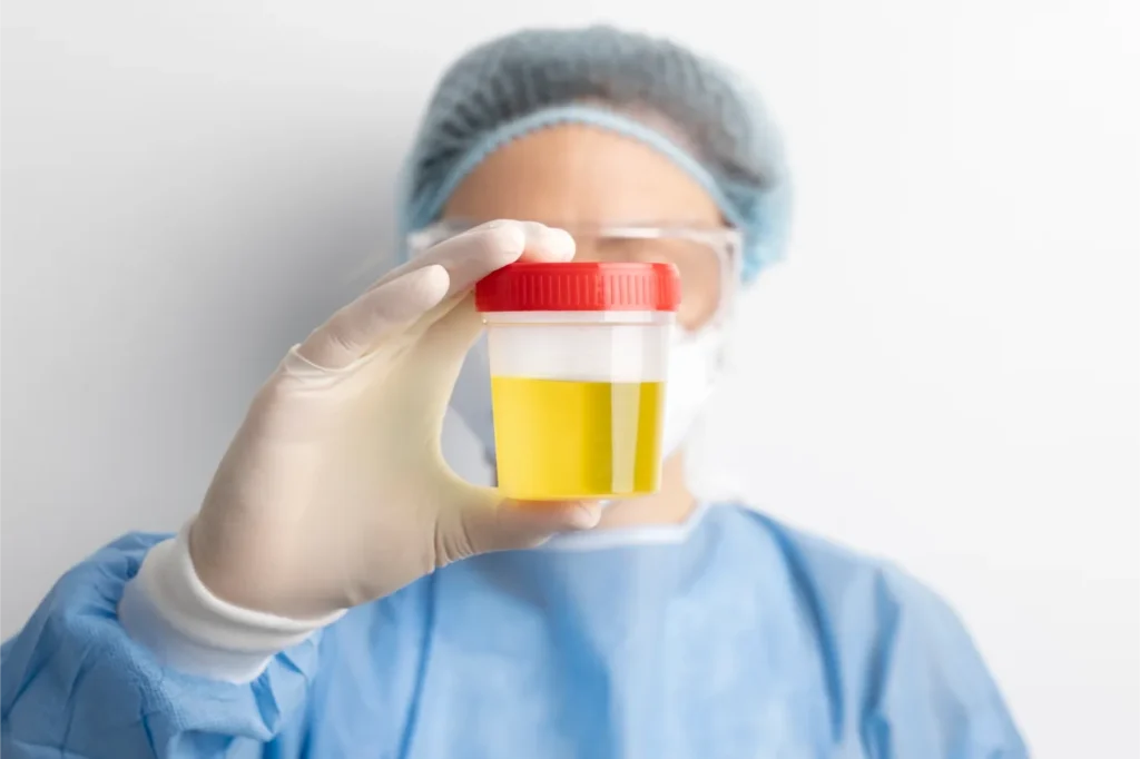 urine test