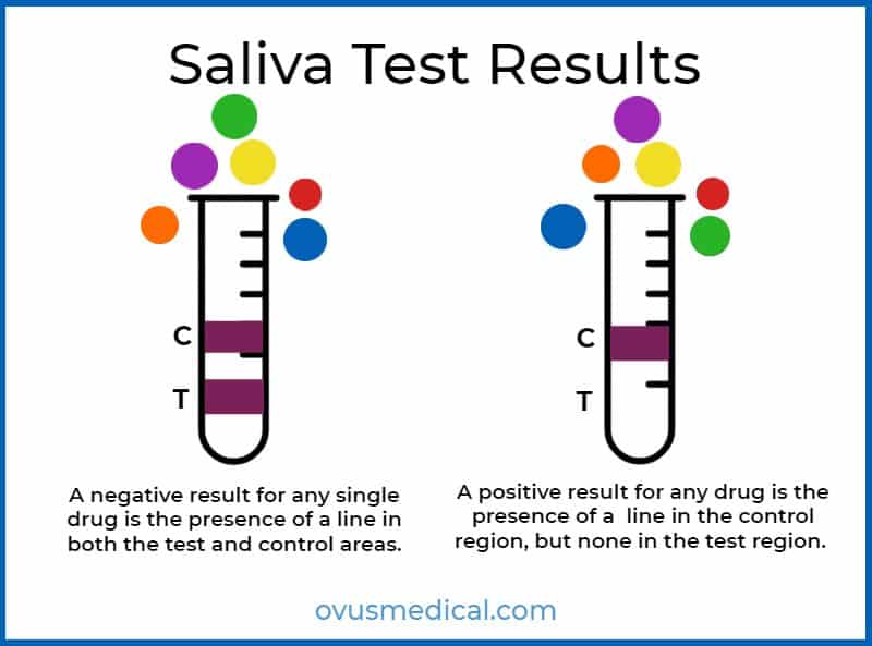 ovus medical Saliva Test Results a