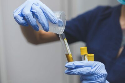 Urine Drug Test Cut Off Levels