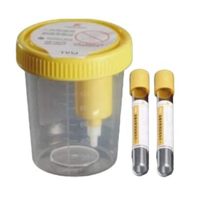 Urine Container Kit with Needle and Vacuum Urine Tube 2