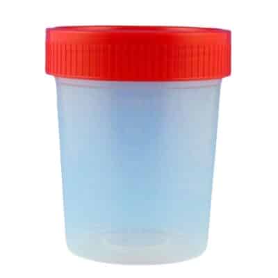 urine specimen container ovusmedical.com