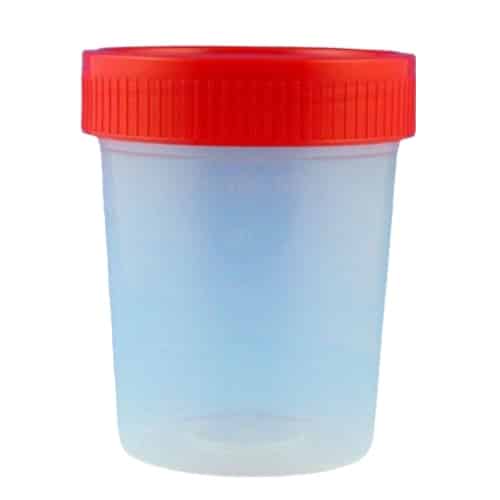 urine specimen container ovusmedical.com
