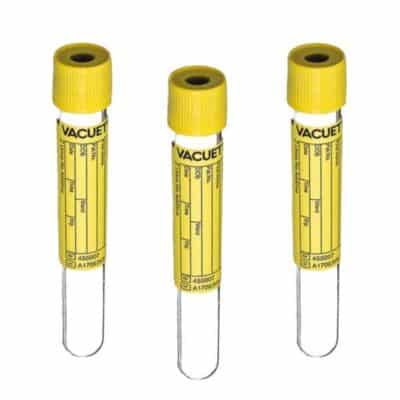 ovusmedical.com Vacuum Urine Tube No Additive