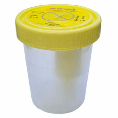 ovusmedical.com urine container with needle CUP