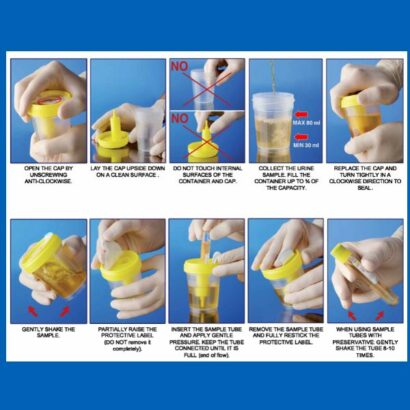 ovusmedical.com urine container with needle INSTRUCTIONS 2